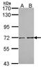 Protein Phosphatase 2 Regulatory Subunit B'Delta antibody, PA5-28445, Invitrogen Antibodies, Western Blot image 
