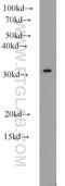 Clathrin Light Chain B antibody, 10455-1-AP, Proteintech Group, Western Blot image 