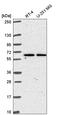 Transmembrane Protein 62 antibody, HPA062359, Atlas Antibodies, Western Blot image 