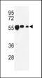 Tubulin Beta 1 Class VI antibody, LS-C161722, Lifespan Biosciences, Western Blot image 