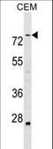 Actin Binding LIM Protein Family Member 3 antibody, LS-C160988, Lifespan Biosciences, Western Blot image 