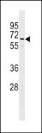 Golgin A8 Family Member B antibody, PA5-49042, Invitrogen Antibodies, Western Blot image 