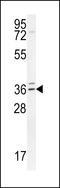 Tubulin Polyglutamylase Complex Subunit 2 antibody, LS-C160135, Lifespan Biosciences, Western Blot image 