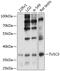 Tumor Suppressor Candidate 3 antibody, 14-516, ProSci, Western Blot image 