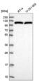 ERCC Excision Repair 4, Endonuclease Catalytic Subunit antibody, NBP2-58407, Novus Biologicals, Western Blot image 