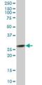 Proteasome 26S Subunit, Non-ATPase 8 antibody, H00005714-B02P, Novus Biologicals, Western Blot image 