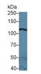 Laminin Subunit Gamma 2 antibody, LS-C295093, Lifespan Biosciences, Western Blot image 