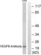 Vascular Endothelial Growth Factor B antibody, LS-C118633, Lifespan Biosciences, Western Blot image 