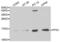 Profilin 1 antibody, abx001078, Abbexa, Western Blot image 