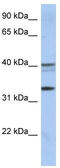 Testis Expressed 264, ER-Phagy Receptor antibody, TA341987, Origene, Western Blot image 