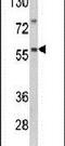 Seryl-TRNA Synthetase 2, Mitochondrial antibody, PA5-14985, Invitrogen Antibodies, Western Blot image 