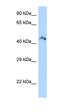 Ribosomal Modification Protein RimK Like Family Member B antibody, orb326023, Biorbyt, Western Blot image 