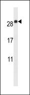 Epithelial membrane protein 2 antibody, PA5-48598, Invitrogen Antibodies, Western Blot image 