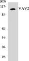 Vav Guanine Nucleotide Exchange Factor 2 antibody, EKC1590, Boster Biological Technology, Western Blot image 