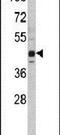 Lysine Methyltransferase 5A antibody, PA5-11278, Invitrogen Antibodies, Western Blot image 