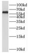 Protein Phosphatase 3 Catalytic Subunit Beta antibody, FNab06728, FineTest, Western Blot image 