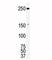 ROS Proto-Oncogene 1, Receptor Tyrosine Kinase antibody, F50673-0.4ML, NSJ Bioreagents, Western Blot image 