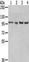 Targeting protein for Xklp2 antibody, CSB-PA251071, Cusabio, Western Blot image 