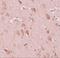 Protein FAM59B antibody, A17028, Boster Biological Technology, Immunohistochemistry paraffin image 