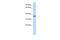 Chromosome 16 Open Reading Frame 46 antibody, 26-712, ProSci, Western Blot image 