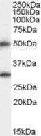 Transmembrane Serine Protease 5 antibody, GTX89957, GeneTex, Western Blot image 