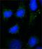 RAB7A antibody, GTX16196, GeneTex, Immunocytochemistry image 