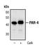 Pro-Apoptotic WT1 Regulator antibody, PA5-17343, Invitrogen Antibodies, Western Blot image 
