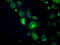 Crystallin Alpha B antibody, LS-C114681, Lifespan Biosciences, Immunofluorescence image 