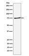 Protein Inhibitor Of Activated STAT 1 antibody, M01707-1, Boster Biological Technology, Western Blot image 