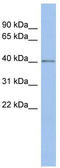 Speckle Type BTB/POZ Protein Like antibody, TA342110, Origene, Western Blot image 