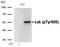 LCK Proto-Oncogene, Src Family Tyrosine Kinase antibody, GTX50349, GeneTex, Western Blot image 