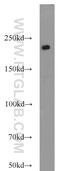 Myosin Heavy Chain 11 antibody, 21404-1-AP, Proteintech Group, Western Blot image 