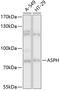 Aspartate Beta-Hydroxylase antibody, 14-822, ProSci, Western Blot image 