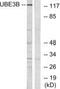 Ubiquitin Protein Ligase E3B antibody, PA5-39522, Invitrogen Antibodies, Western Blot image 