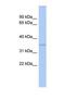 C-Type Lectin Domain Family 4 Member G antibody, NBP1-69237, Novus Biologicals, Western Blot image 