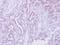 Cell Adhesion Associated, Oncogene Regulated antibody, GTX105422, GeneTex, Immunohistochemistry paraffin image 