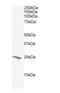 BCL2 Antagonist/Killer 1 antibody, orb18359, Biorbyt, Western Blot image 