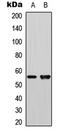 Polo Like Kinase 1 antibody, LS-C368472, Lifespan Biosciences, Western Blot image 