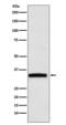 Growth Differentiation Factor 15 antibody, M01583-1, Boster Biological Technology, Western Blot image 