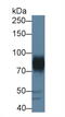 ADAM Metallopeptidase Domain 22 antibody, abx131305, Abbexa, Western Blot image 