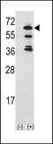 Activated CDC42 kinase 1 antibody, LS-C155931, Lifespan Biosciences, Western Blot image 