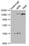 5-Methyltetrahydrofolate-Homocysteine Methyltransferase antibody, LS-C379236, Lifespan Biosciences, Immunoprecipitation image 