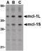 MCL1 Apoptosis Regulator, BCL2 Family Member antibody, PA5-20122, Invitrogen Antibodies, Western Blot image 