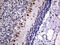 Solute Carrier Family 22 Member 17 antibody, M09733, Boster Biological Technology, Immunohistochemistry paraffin image 