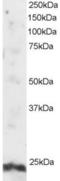 ADP Ribosylation Factor Like GTPase 4A antibody, LS-C54536, Lifespan Biosciences, Western Blot image 