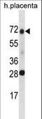 Serine Peptidase Inhibitor, Kunitz Type 1 antibody, LS-C161456, Lifespan Biosciences, Western Blot image 