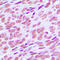 Cyclin E1 antibody, LS-C353930, Lifespan Biosciences, Immunohistochemistry paraffin image 