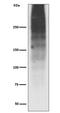 Mucin 16, Cell Surface Associated antibody, M01641, Boster Biological Technology, Western Blot image 