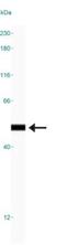 High Mobility Group Box 1 antibody, NBP2-27400, Novus Biologicals, Western Blot image 