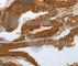 Notch Receptor 3 antibody, A3115, ABclonal Technology, Immunohistochemistry paraffin image 